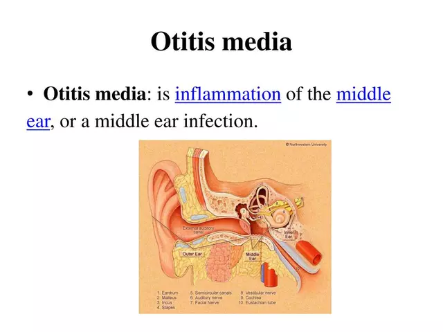 The connection between azelastine and otitis media